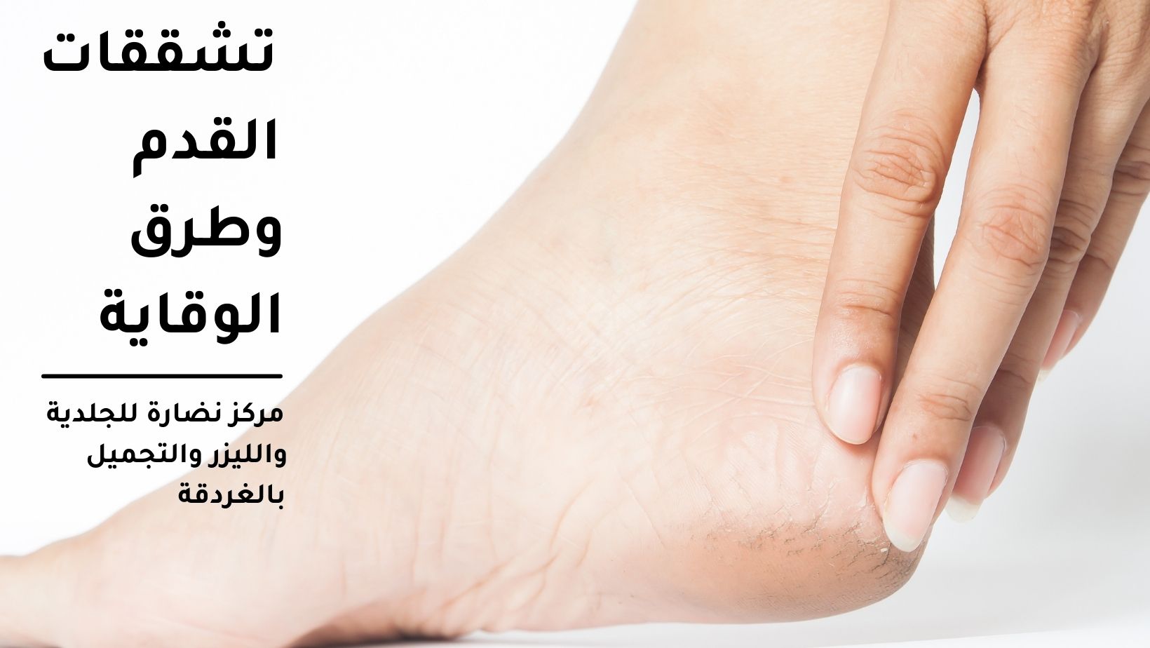 تشققات القدم وطرق الوقاية